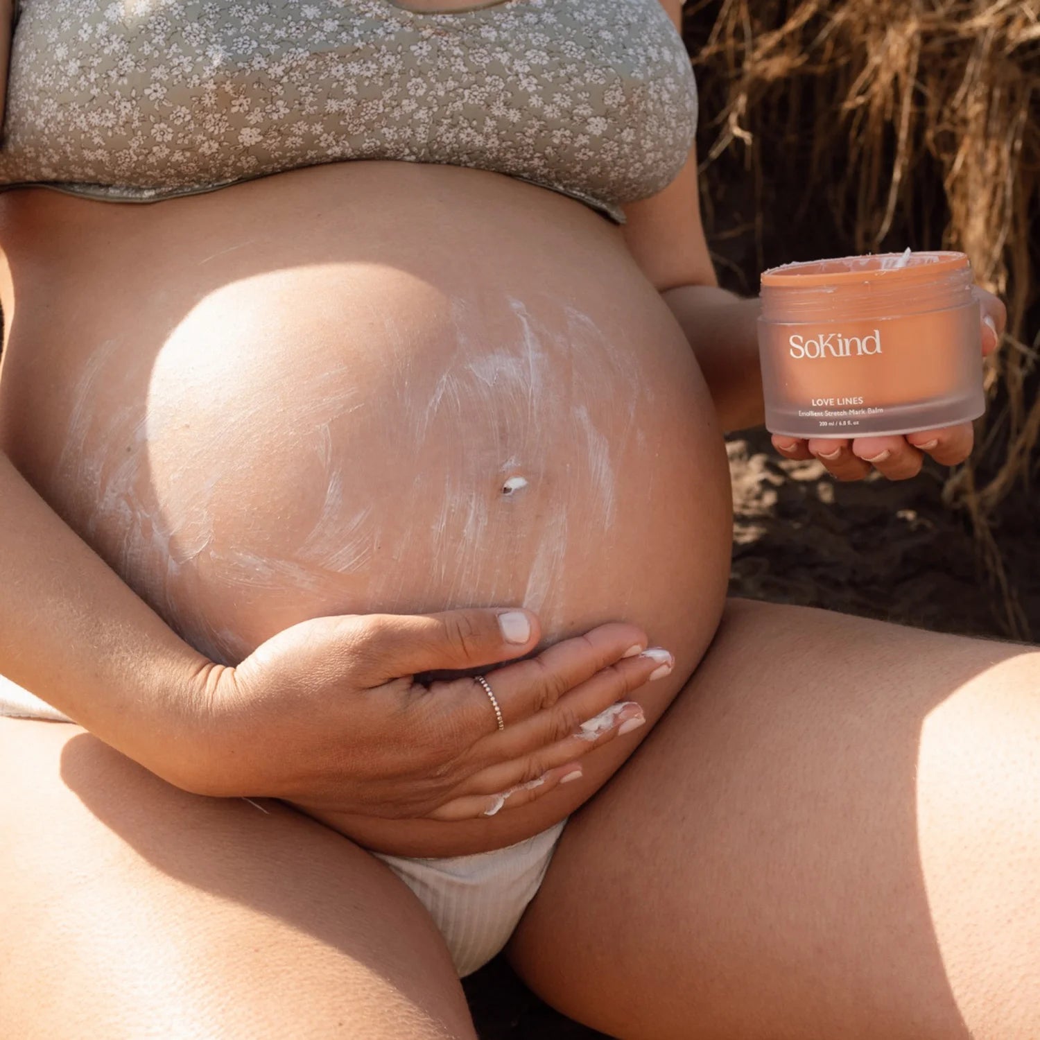 SoKind Stretch Mark Body Cream, 200 ml